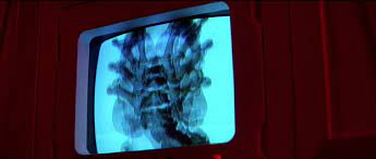 Ripley's CAT scan